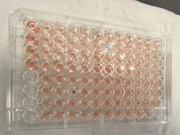 高升网 首例！广东顺德发现一例“钻石血”，比“熊猫血”罕见百倍